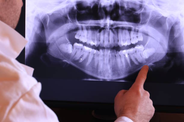 Best After-Hours Emergency Dentist in Lyman, SC